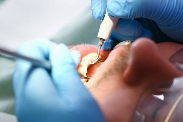 Best Emergency Dentist for Knocked-Out Tooth in Fall River, MA