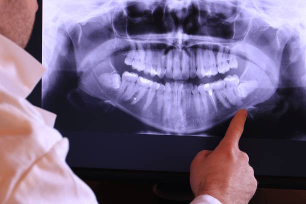 Best Pediatric Emergency Dentist in Fall River, MA